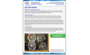 Vascular Case Review: Thalamus and Brainstem Cavernous Malformation 