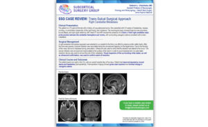 Vascular Case Review: Right Cerebellar Metastasis