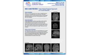 Tumor Case Review: Left Occipital Metastasis