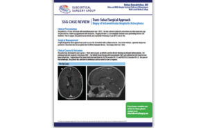 Tumor Case Review: Biopsy of Intraventricular Anaplastic Astrocytoma