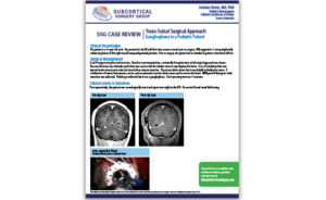 Tumor Case Review: Ganglioglioma with Methylene Blue Injection