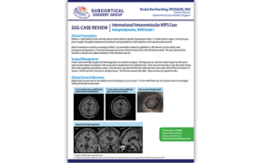 Subependymoma WHO Grade 1 MIPS Resection Case Review