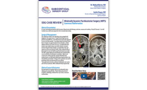 Vascular Case Review: Pediatric Cavernous Malformation